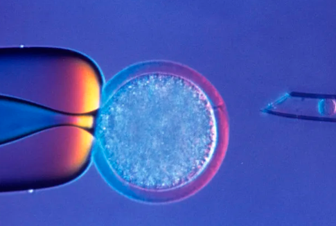 国内哪个医院捐卵,2026*纵隔术后做试管*率高吗*纵隔能做试管吗