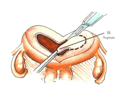 国内试管供卵医院哪家好,试管婴儿超短方案具体流程,试管婴儿短方案详细流程