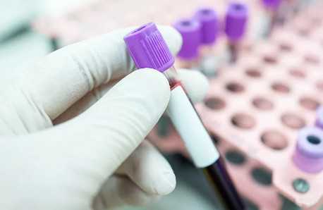 中国能做供卵试管的,打夜针当天雌二醇上升到1100pg/ml能取出几个成熟卵泡？看这篇就够了