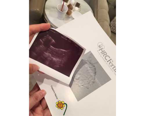 国内哪些医院可以供卵生子,帕陶氏综合征做试管能成功吗，帕陶综合症患者通过三代试管可以实现健康生育