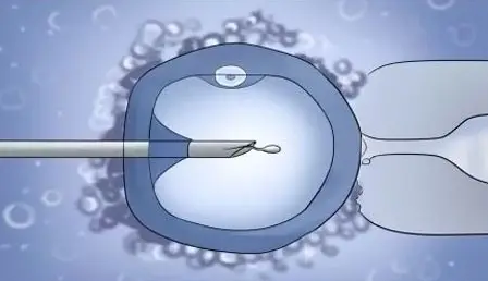 国内代生儿子微信,多年不孕别灰心？一般要花多少！